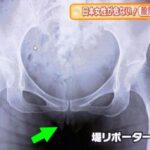 【画像】女子アナさん恥部を全国に晒してしまうwwwwwwwwwwww