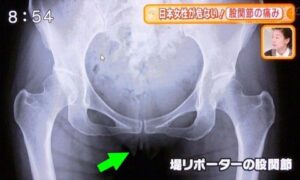 【画像】女子アナさん恥部を全国に晒してしまうwwwwwwwwwwww