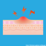 【緊急】太ももが変な事になってる、何これ？