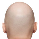 【議論】坊主頭って恋愛厳しいのかな！？