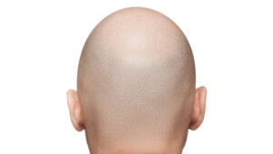 【議論】坊主頭って恋愛厳しいのかな！？