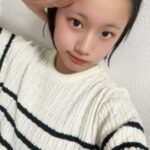 【画像】こういうおでこの女ｗｗｗｗｗｗｗｗｗｗｗｗｗｗｗｗｗｗｗｗｗｗｗｗ