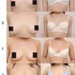 【画像】巨乳のメリットはわかるが貧乳のメリットある