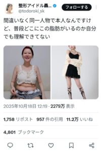 【画像】整形を公言している美人アイドル女子さんのすっぴん！