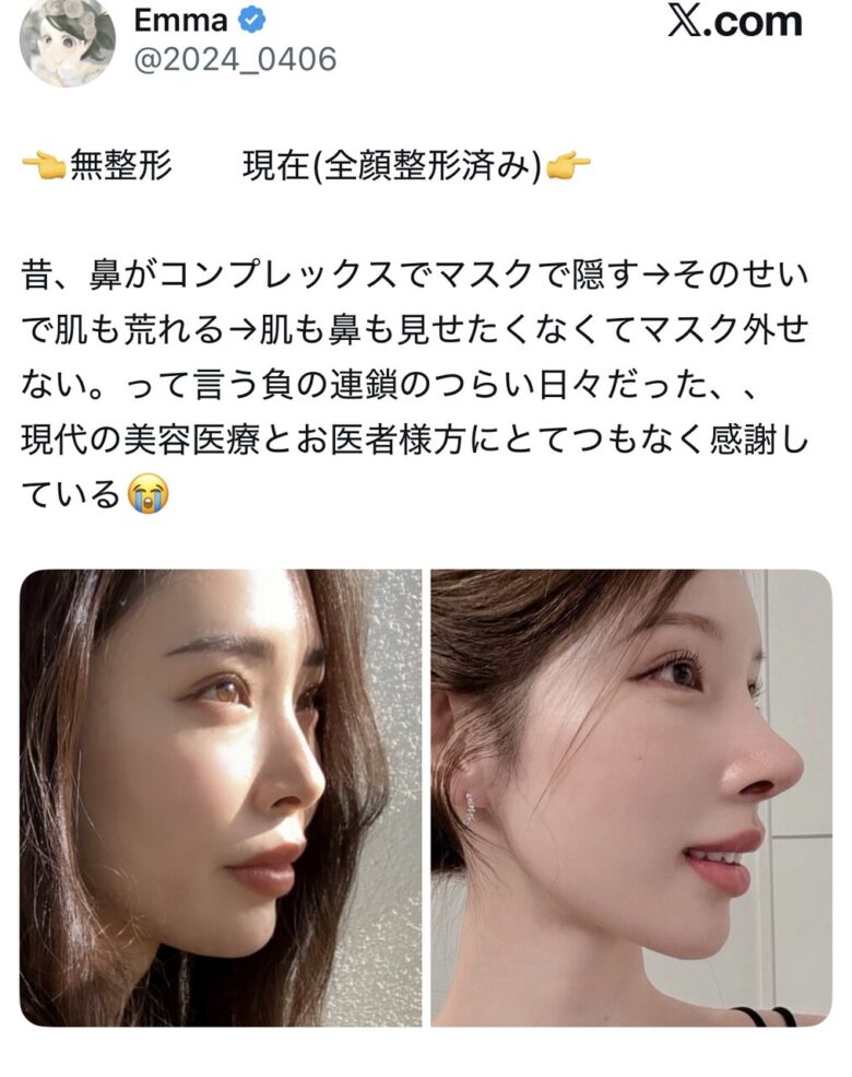 【朗報】女さん、整形で超絶美人になってしまう